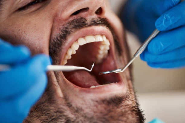 Best Root Canal Emergency Dentist  in Salem, NJ